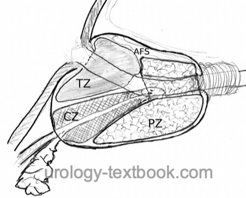 fig. prostate zones after McNeal, transition zone, central zone, peripheral zone 