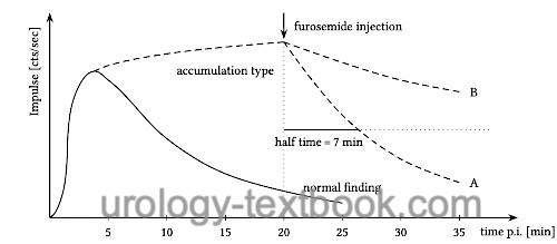 figure normal findings of Dynamic renal scintigraphy