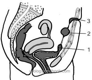 fig. patent urachus and urachal cysts
