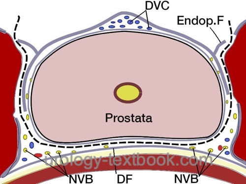 figure: Interfascial technique: standard technique for nerve sparing. The layer between the prostatic fascia and the endopelvic fascia is opened, the Denovilliers fascia is left on the rectum.