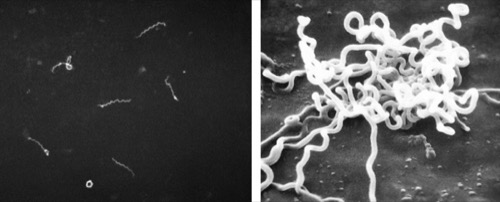 treponema pallidum (pathogen of syphilis) in dark field and elektron microscopy