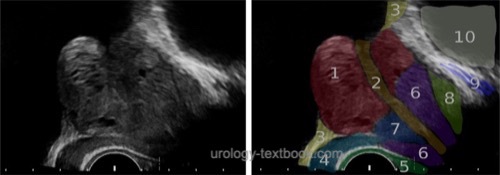 figure Transrectal ultrasonography of the prostate:  prostate zones in sagittal plane
