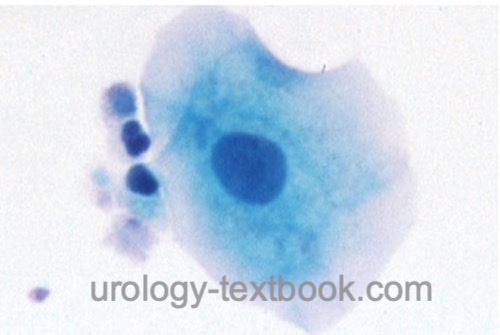 figure normal urine cytology