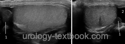 figure ultrasound examination of the testis