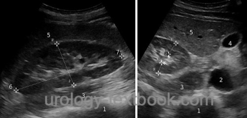 figure ultrasound anatomy of the kidney