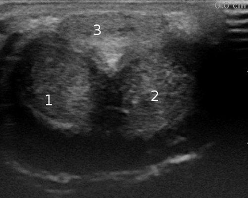 figure ultrasound examination of the penis from ventral