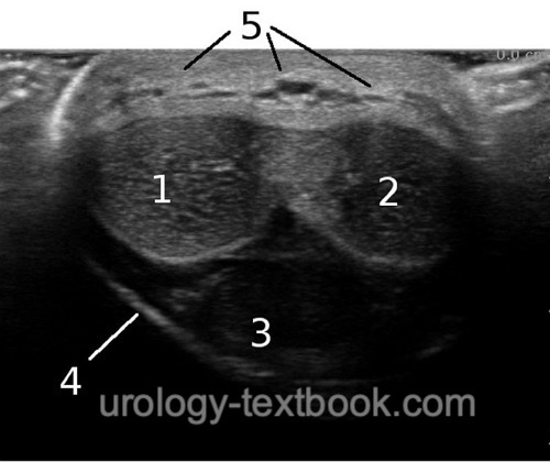 figure ultrasound examination of the penis from ventral