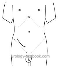 fig. gibson incision