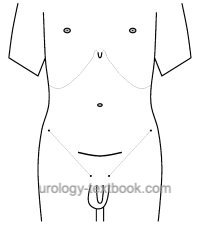 fig. skin incision for a pfannenstiel incision