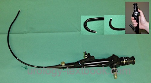 figure flexible cystoscope